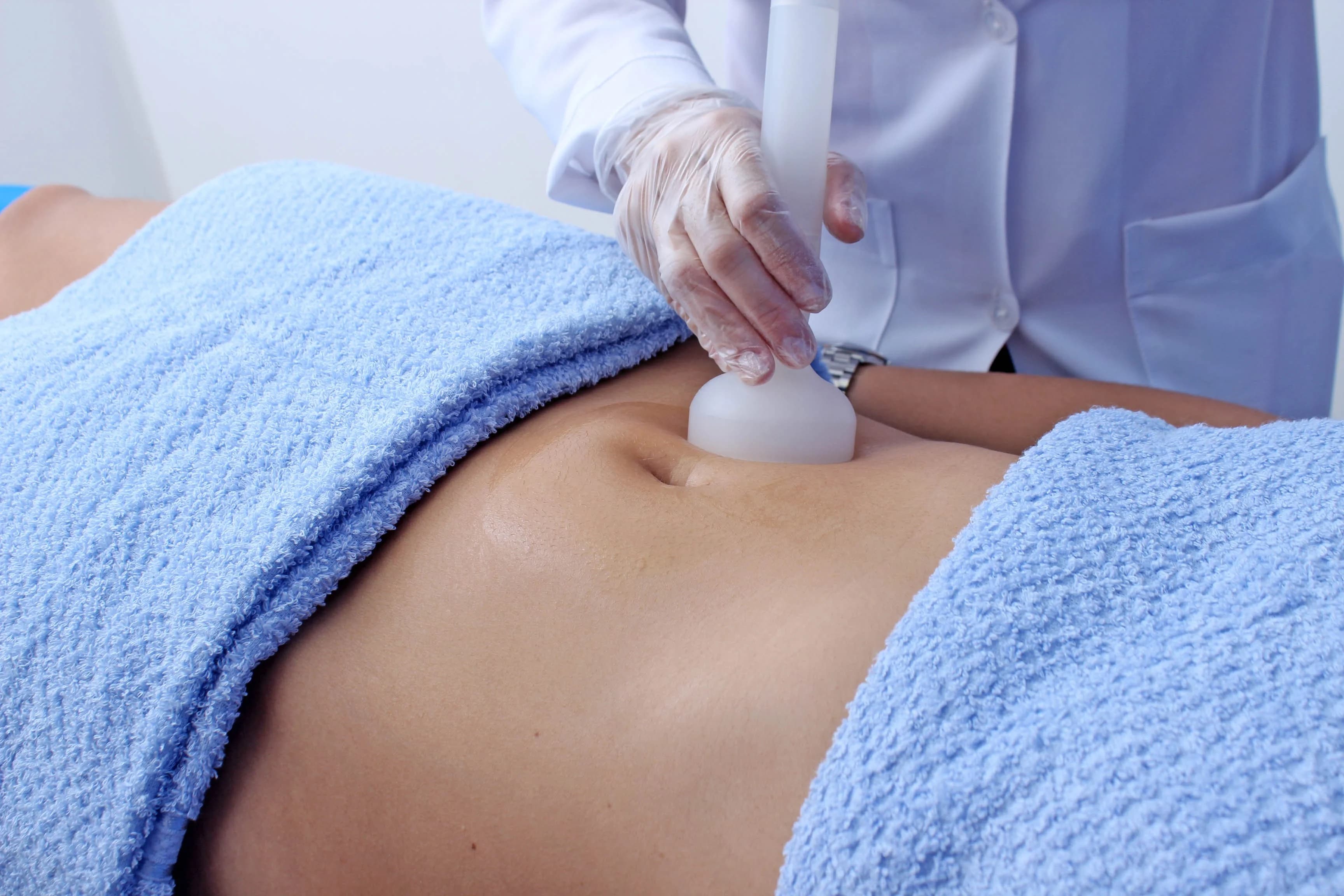 Endermoterapia