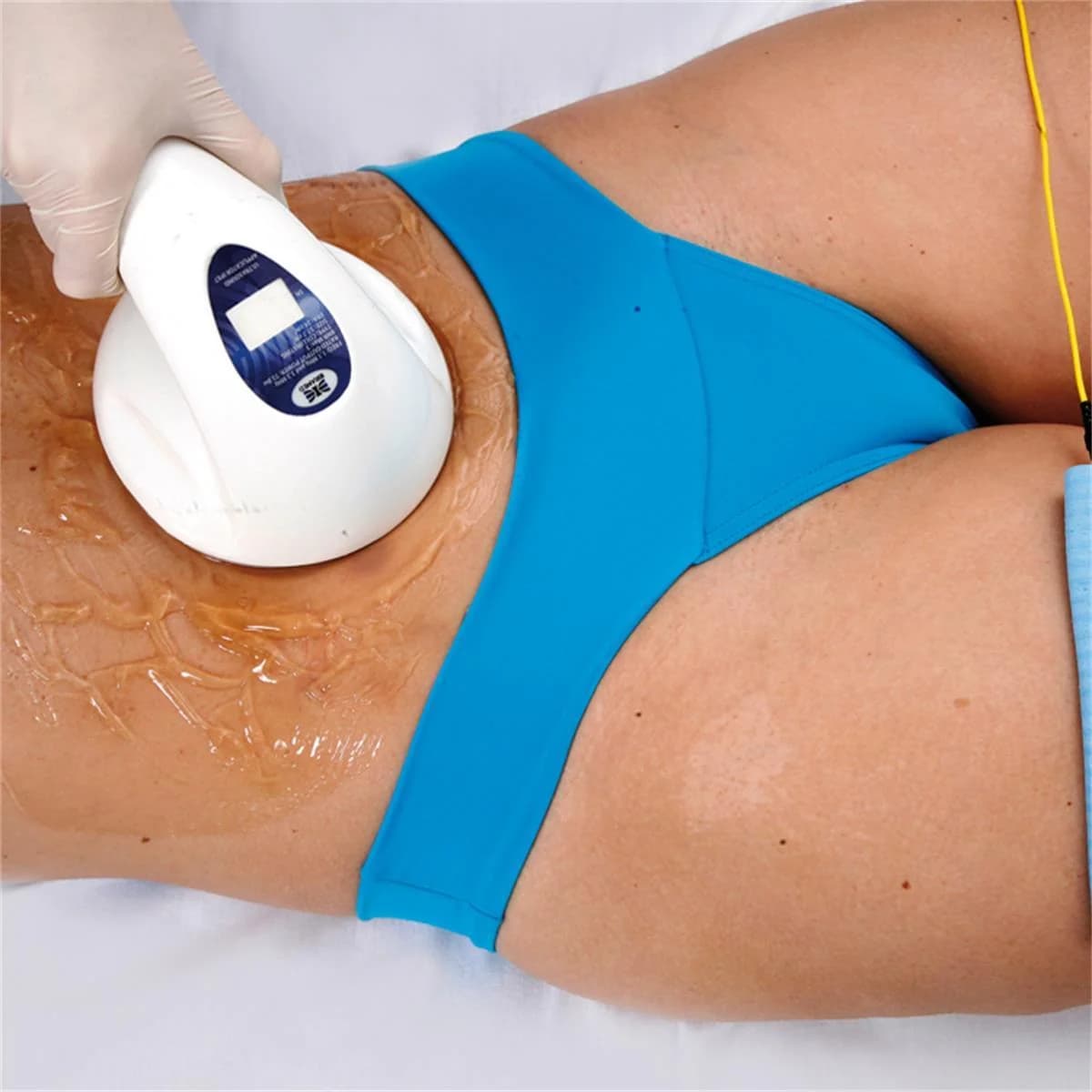 Ultrassom estético